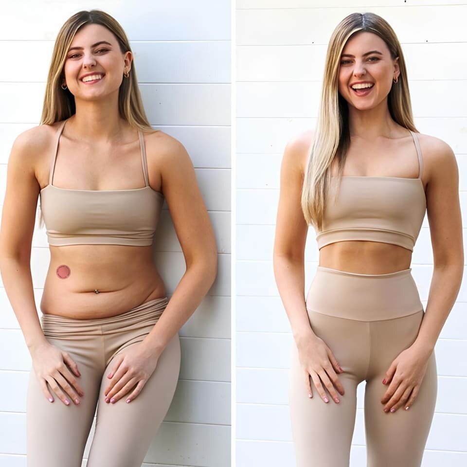 Murwon Berberine Patches image